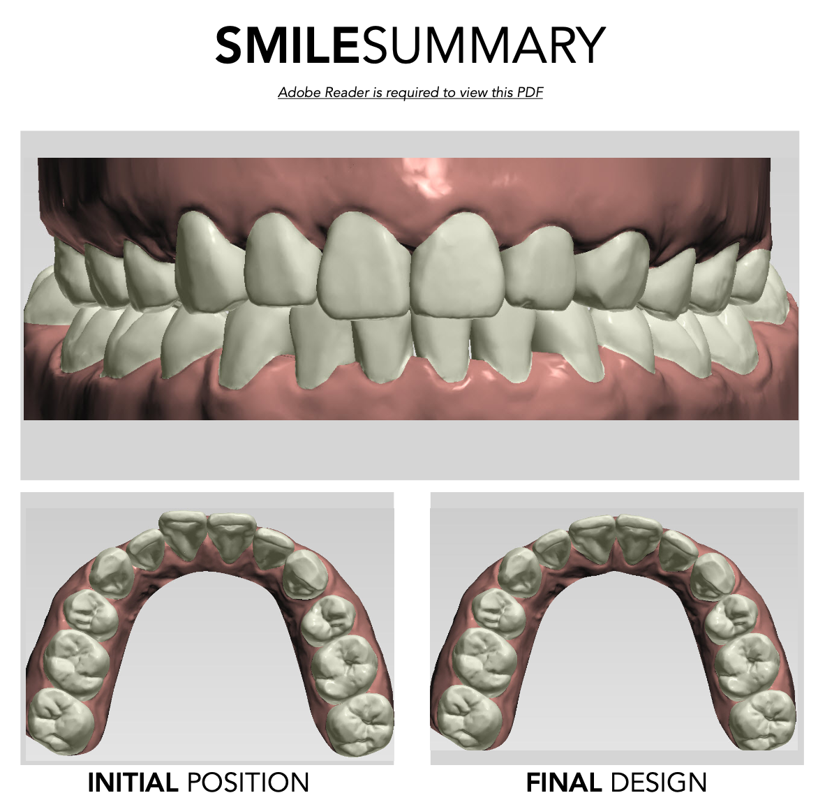 video mô phỏng hình ảnh răng 3D