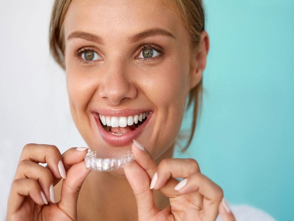 Vì sao cần vệ sinh và chăm sóc răng miệng khi niềng răng?