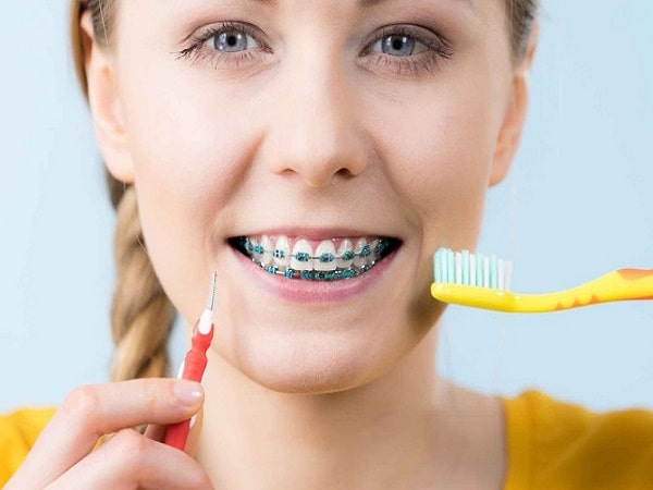 Cách chăm sóc răng miệng khi niềng răng đúng cách