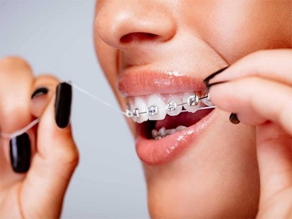 Chăm sóc răng miệng bằng cách dùng chỉ nha khoa