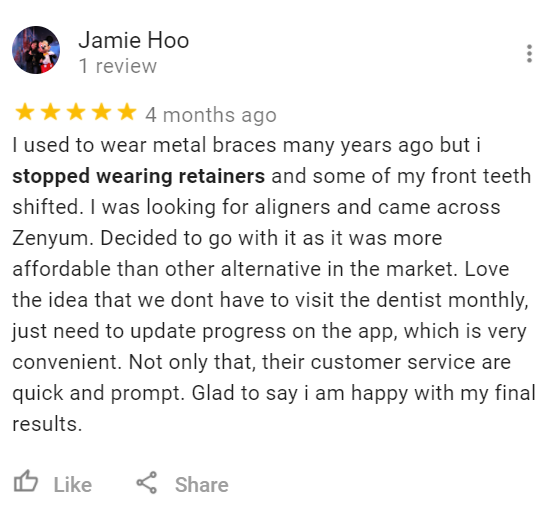 zenyum review jamie