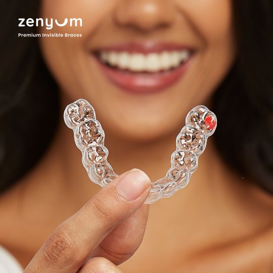 Niềng răng trong suốt Zenyum giúp quá trình điều trị trở nên thoải mái hơn rất nhiều