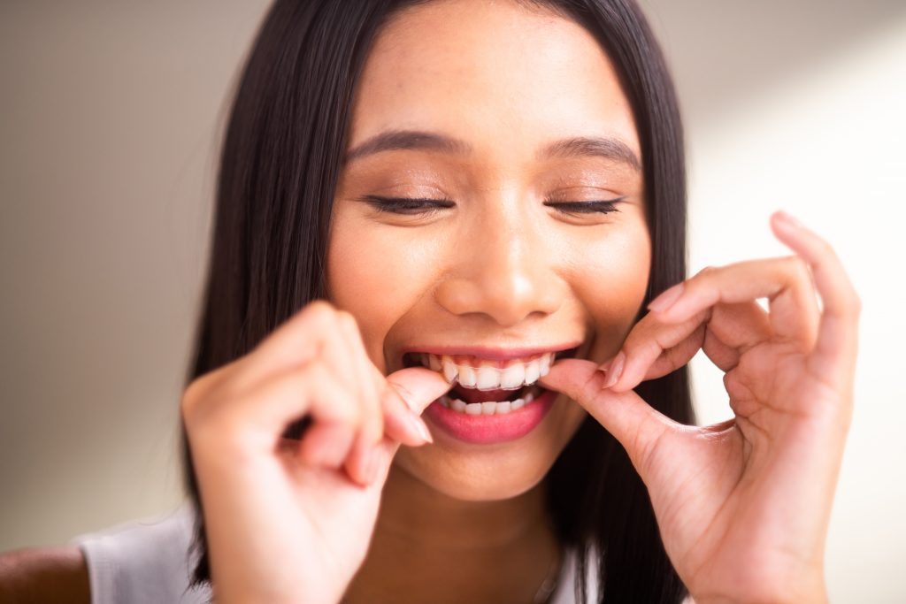 Phương pháp niềng răng trong suốt giá bao nhiêu?