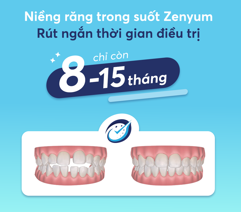 Quy trình niềng răng Zenyum an toàn, thời gian điều trị được rút ngắn nhưng hiệu quả niềng vẫn được đảm bảo